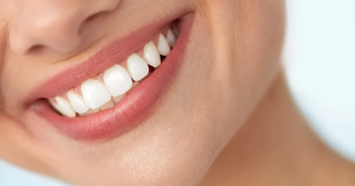 A smiling woman after bulimia Cosmetic Dentistry in Allentown, PA