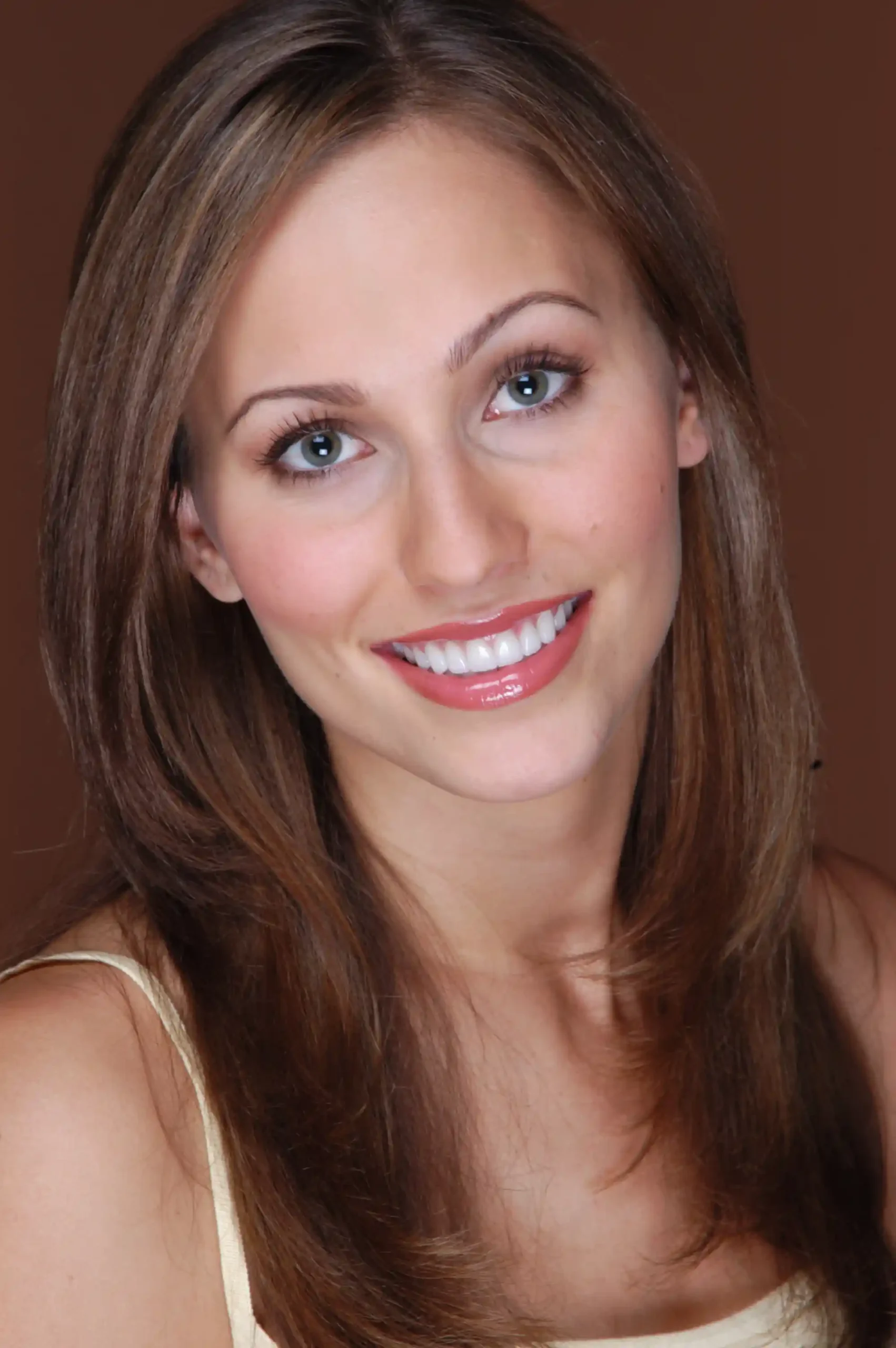 Prepless Veneers in Allentown PA